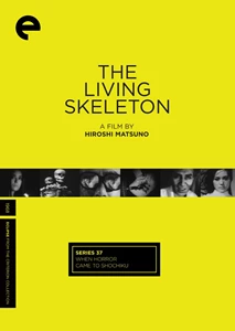 The Living Skeleton